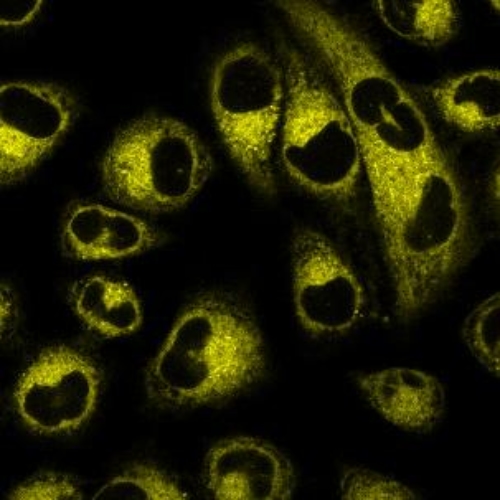 Endoplasmic Reticulum